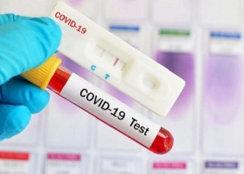 Anggota DPRD Tanjabbar dan 15 Staf Jalani Rapid Test, Ini Hasilnya