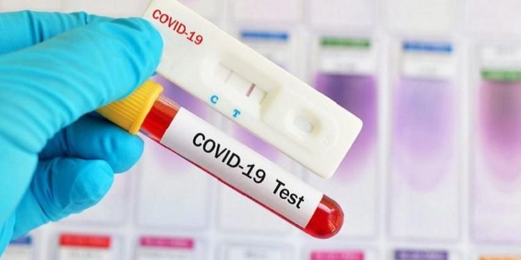 Anggota DPRD Tanjabbar dan 15 Staf Jalani Rapid Test, Ini Hasilnya